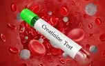 creatinine کراتینین چیست؟ + جدول