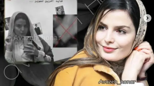 عکس / تغییر چهره غزاله اکرمی بازیگر سریال سوجان در قامت شازده معلول قجری / غزاله اکرمی:  برخی براین باور بودند که من واقعا معلول هستم !