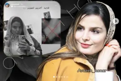 عکس / تغییر چهره غزاله اکرمی بازیگر سریال سوجان در قامت شازده معلول قجری / غزاله اکرمی:  برخی براین باور بودند که من واقعا معلول هستم !