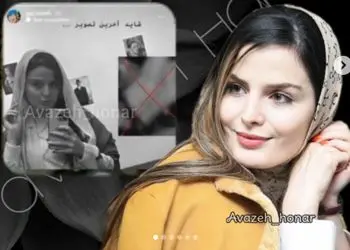 عکس / تغییر چهره غزاله اکرمی بازیگر سریال سوجان در قامت شازده معلول قجری / غزاله اکرمی:  برخی براین باور بودند که من واقعا معلول هستم !