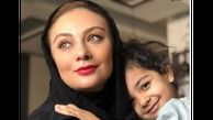 یکتا ناصر با عمل هایی زیبایی چهره اش را مصنوعی کرد + عکس های کودکی !