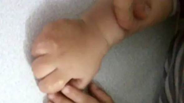 اتفاقی عجیب / نوزاد 2 روزه در قطع شدن انگشتانش داخل بیمارستان 25 درصد مقصر شناخته شد! + تصاویر تکاندهنده