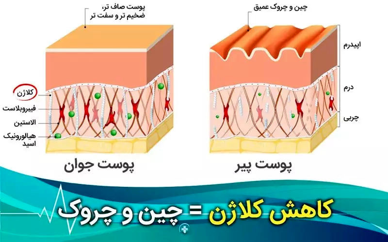 کاهش کلاژن