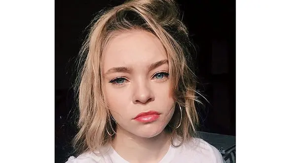 صورت بازیگر زن به خاطر آسیب دیدن در صحنه فیلمبرداری 70 بخیه خورد + عکس