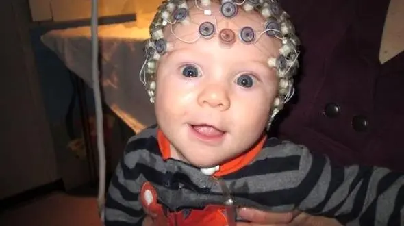 به کمک اسکن مغزی اوتیسم شناسایی می شود