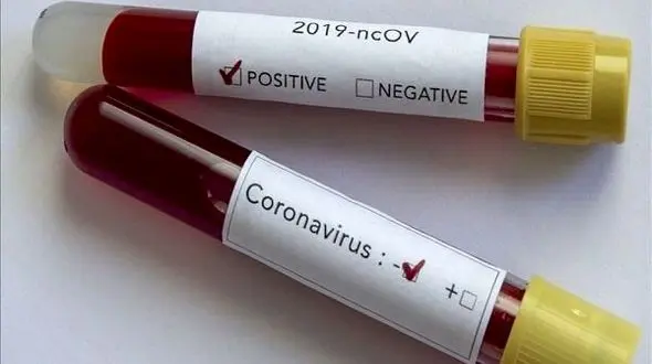 کرونا جان 3 گلستانی را گرفت 