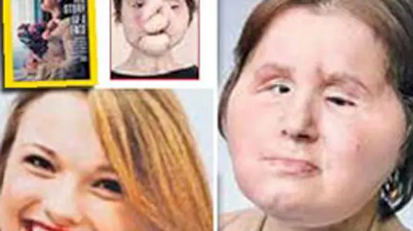 این زن زیبا ناگهان زشت شد‌+ عکس های باورنکردنی