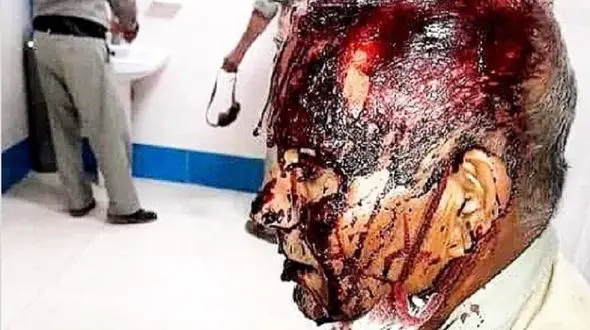 ضرب‌ و شتم وحشیانه محیط‌بان توسط شکارچیان در اصفهان + عکس