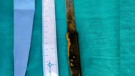  خروج چاقوی ۲۰ سانتی از کبد مرد هندی جراحان را شگفت‌ زده کرد+ عکس