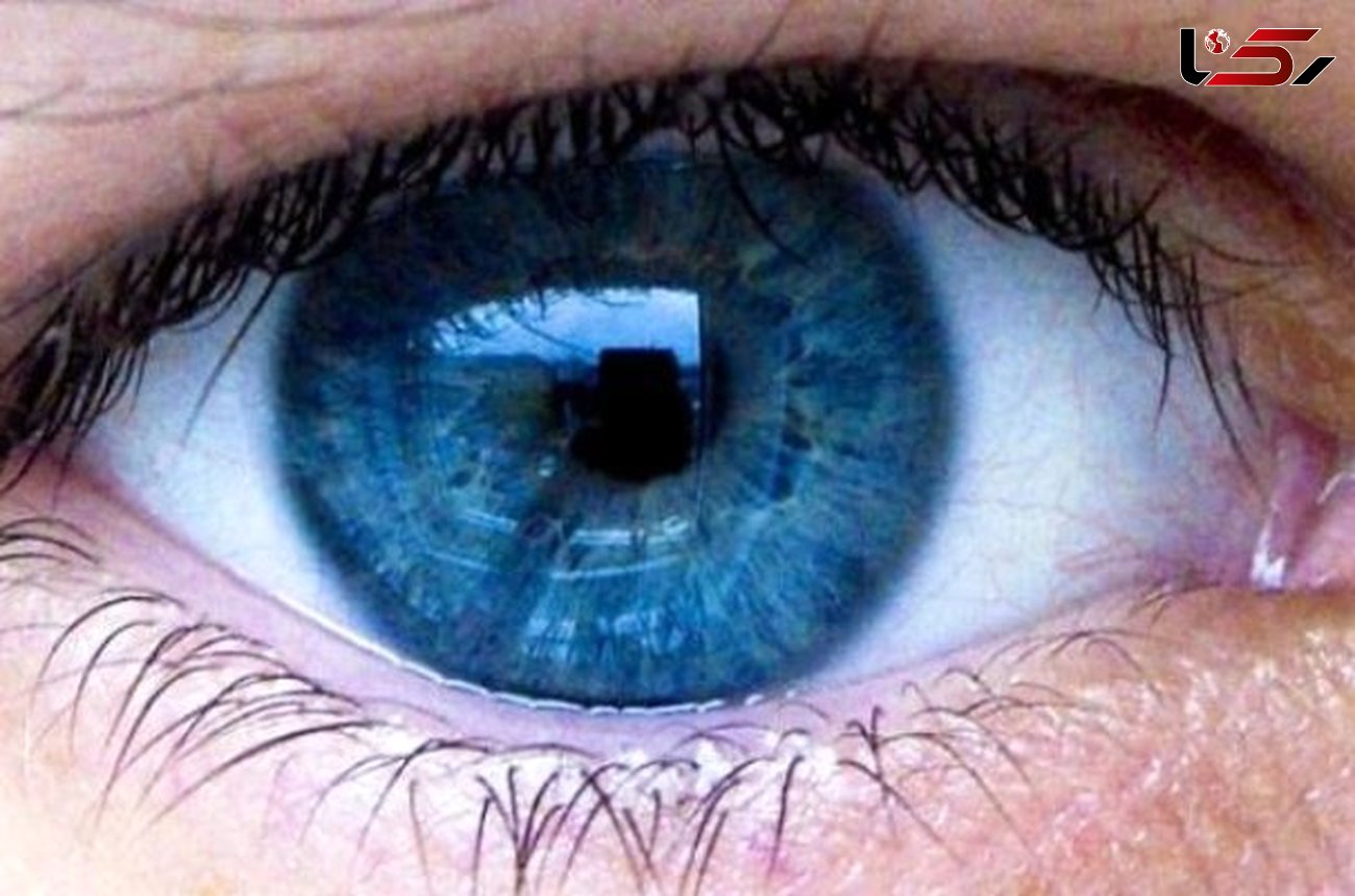 5 راهکار سلامت چشم ها