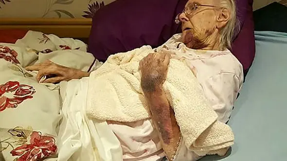 بلای وحشتناکی که یک پرستار به سر زن سالمند آورد +تصاویر