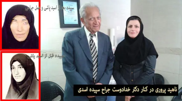 ناگفته هایی از انسانیت دکتر خدادوست از زبان خانم خبرنگار و سپیده قربانی اسید پاشی + عکس