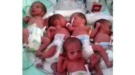 پنج قلوزایی نادر در یزد /  وزن این نوزادان بین ۵۴۰ گرم تا یک کیلو و ۷۰۰ گرم اعلام شده است