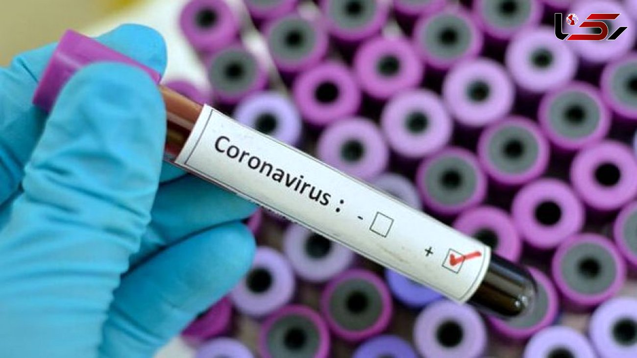 چگونه از خود در برابر  کروناویروس مراقبت کنیم 