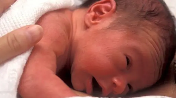 مرگ ۵۰۰ هزار نوزاد در جهان به خاطر آلودگی هوا