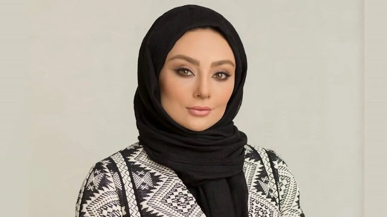 لو رفتن همه عمل های زیبایی یکتا ناصر در ۴۴ سالگی  / از عمل فک تا تزریق ژل !