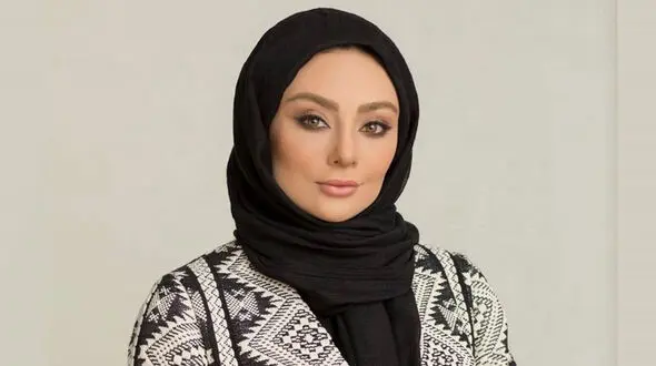 لو رفتن همه عمل های زیبایی یکتا ناصر در ۴۴ سالگی  / از عمل فک تا تزریق ژل !