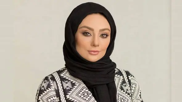 لو رفتن همه عمل های زیبایی یکتا ناصر در ۴۴ سالگی  / از عمل فک تا تزریق ژل !