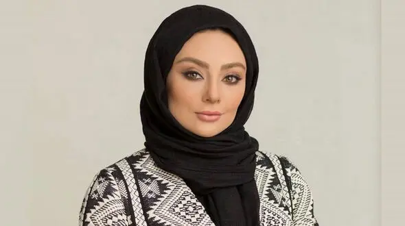 لو رفتن همه عمل های زیبایی یکتا ناصر در ۴۴ سالگی  / از عمل فک تا تزریق ژل !
