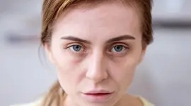 صبح‌ ها صورت تان ورم می‌کند؟ 6 علت پف صورت که باید بدانید