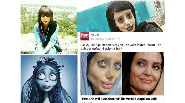 دختر ایرانی پس از 50 جراحی پلاستیک، عروس مرده شد! + تصاویر