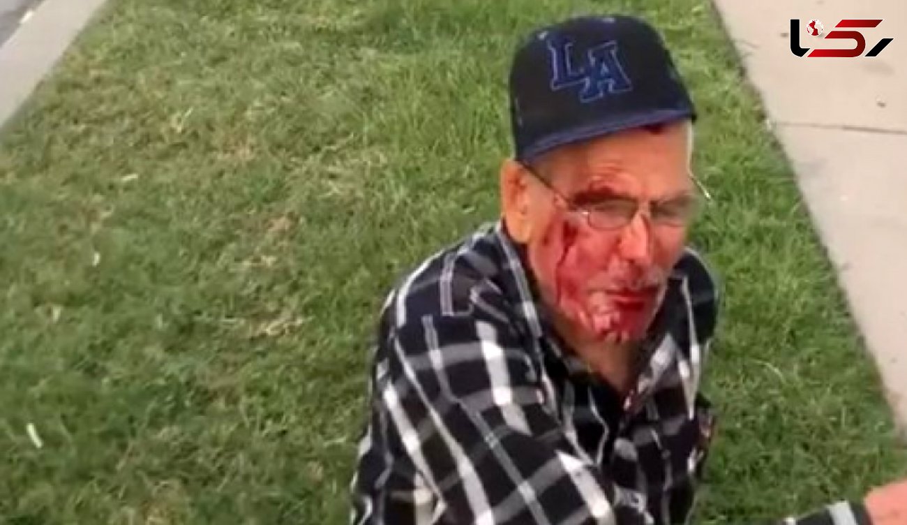  حمله نژادپرستانه با آجر به پیرمرد ۹۲ ساله در لس آنجلس + عکس 