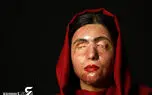 گفتگوی تکاندهنده با زن بی چهره ایران ! / معصومه عطایی کیست؟! + فیلم اختصاصی