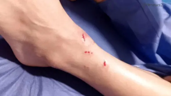 فیلم لحظه هجوم گرگ در محوطه دانشگاه زنجان / دانشجو زخمی شد