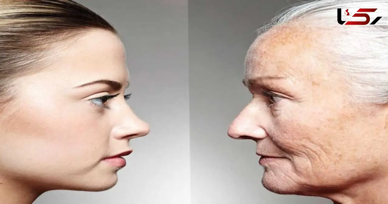آغاز پیری پوست چه سنی است؟
