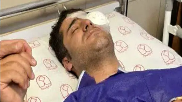 رایزنی رییس سازمان حفاظت محیط زیست برای درمان محیط‌بان مصدوم اصفهانی 