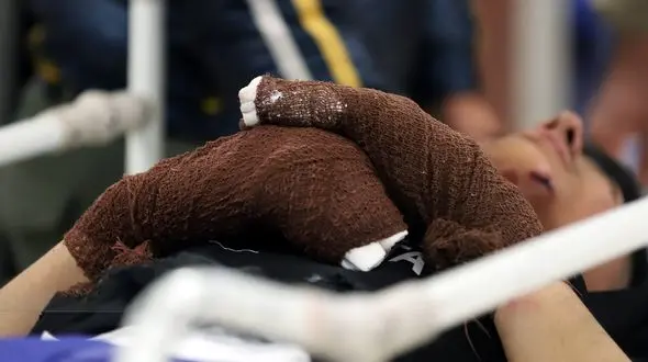 قطع سه انگشت دست با  انفجار ترقه