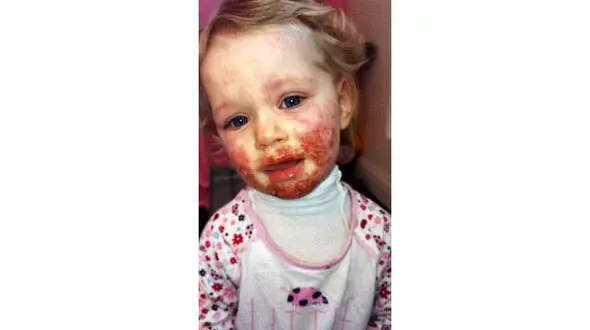 زیبایی این دختر با یک بوسه بر باد رفت+عکس