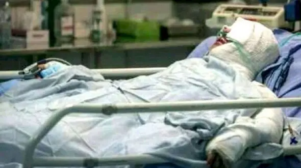 قطع دست جوان 21 ساله ساوجی / چهارشنبه سوری نیامده قربانی گرفت