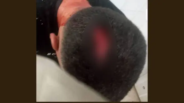 حمله خونین دستفروها به شهردارچی در مسجدسلیمان / سرش شکافته شد!