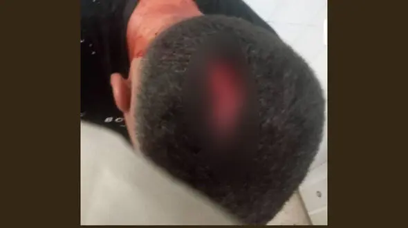 حمله خونین دستفروها به شهردارچی در مسجدسلیمان / سرش شکافته شد!