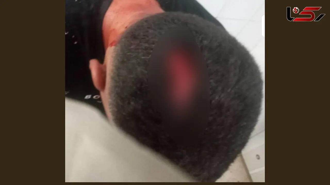 حمله خونین دستفروها به شهردارچی در مسجدسلیمان / سرش شکافته شد!