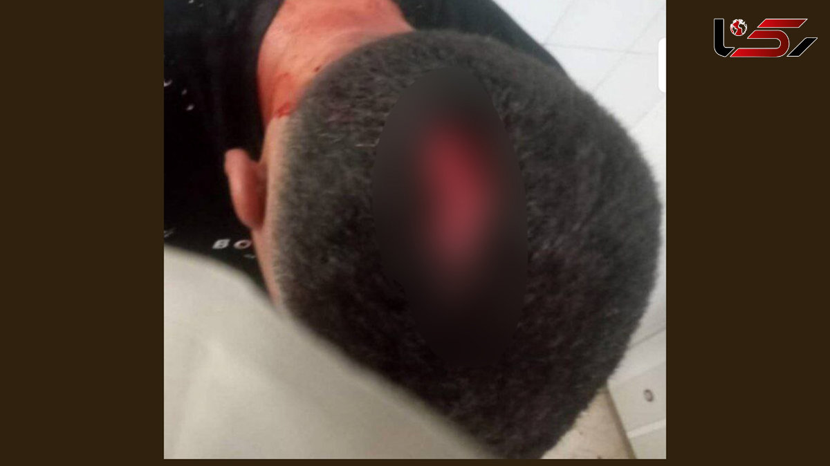  حمله خونین دستفروها به شهردارچی در مسجدسلیمان / سرش شکافته شد! 