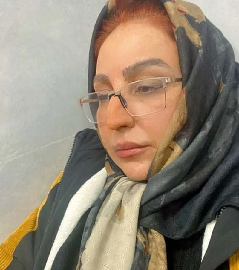 بهنوش بختیاری بدون آرایش