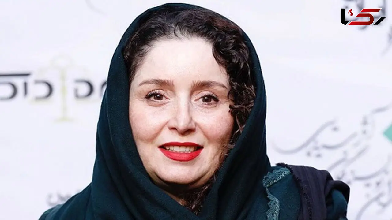  ژاله صامتی چی بود و چی شد ؟! / او هم عمل زیبایی دارد ! + عکس را مقایسه کنید
