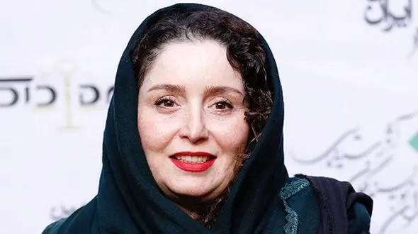  ژاله صامتی چی بود و چی شد ؟! / او هم عمل زیبایی دارد ! + عکس را مقایسه کنید