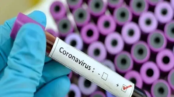 زنانی که فرزند خود را در شکم شان دارند مراقب کرونا باشند