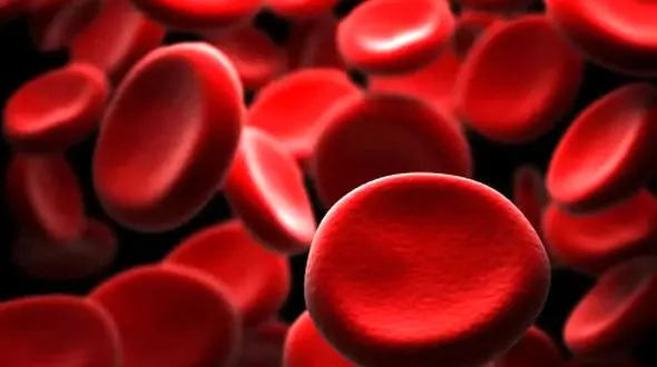 نشانه‌ های پنهان کم‌ خونی و روش‌ های تشخیص آن / اینفوگرافیک