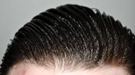 درمان موهای چرب با راهکارهای آسان و طبیعی 