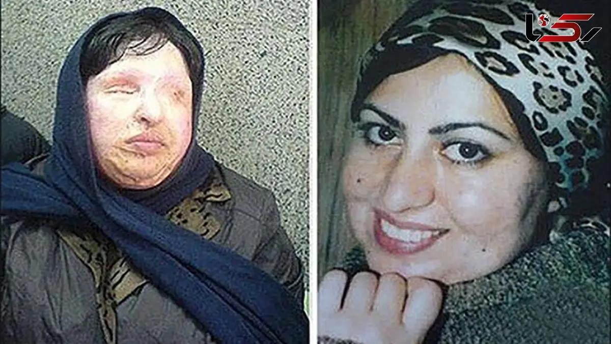 شکایت جدید آمنه بهرامی قربانی جنجالی ترین اسیدپاشی ایران بعد از 21 سال از پسر اسیدپاش / آمده ام تا ...