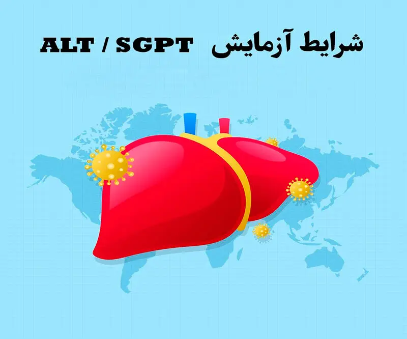 sgpt alt در آزمایش خون