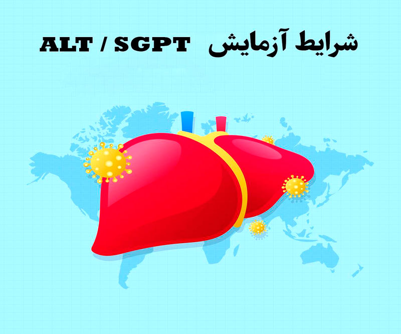 sgpt alt در آزمایش خون