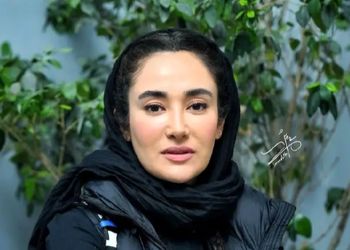 عکس/تغییر چهره عجیب و ناگهانیِ بهاره افشاری!/ چقدر ناز و عروسکی شده / چه کارایی انجام داده رو صورتش؟!