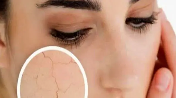 12 روش مبارزه با خشکی پوست