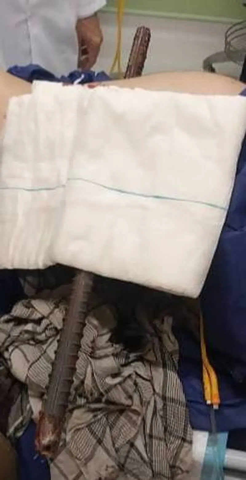 سقوط کارگر از ارتفاع