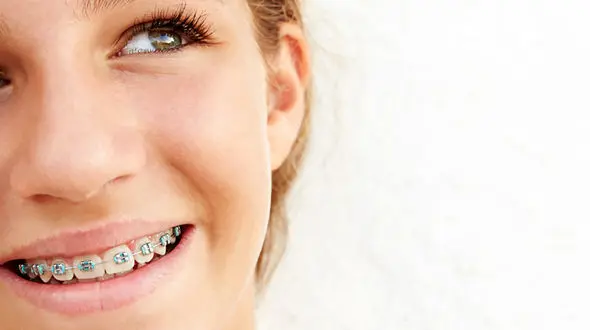 تاثیر استفاده نادرست از کفش‌های مناسب بر نظم دندان ها/ تنها راه صاف کردن دندان ها ارتودنسی نیست 